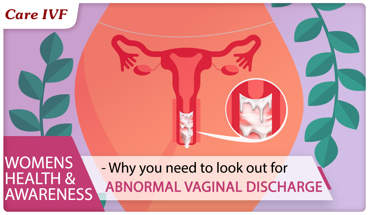Vaginal discharge – misconceptions, causes and treatments
