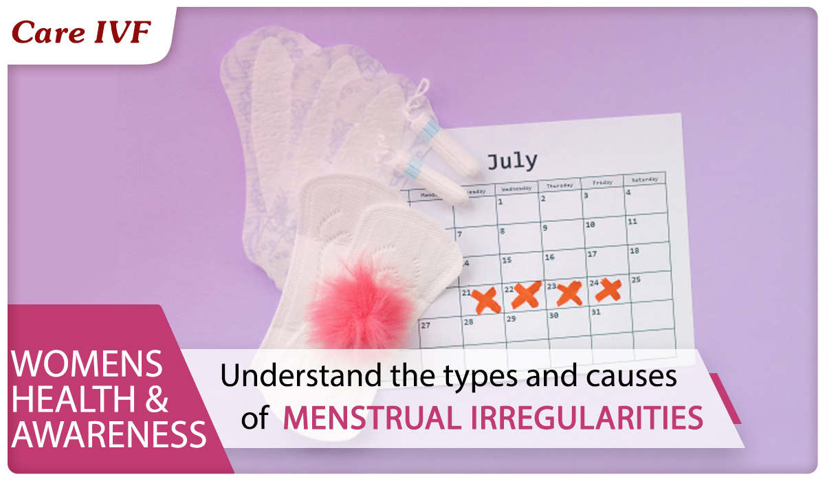 Irregular menstruation - Symptoms, types, causes and prevention.